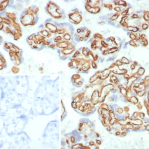 Formalin-fixed, paraffin-embedded human placenta stained with CD31 Rabbit Recombinant Monoclonal Antibody (C31/8359R). Inset: PBS instead of primary antibody; secondary only negative control.