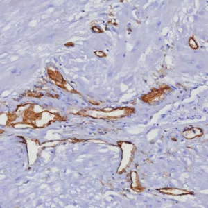 Formalin-fixed, paraffin-embedded human uterus stained with CD31 Rabbit Recombinant Monoclonal Antibody (C31/8377R). HIER: Tris/EDTA, pH9.0, 45min. 2: HRP-polymer, 30min. DAB, 5min.
