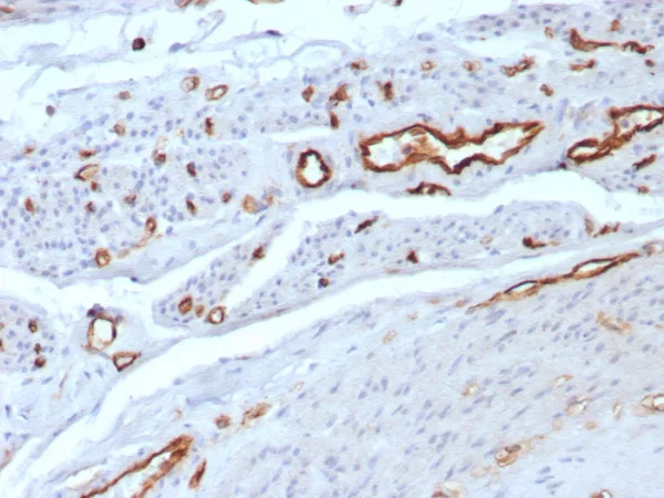 Formalin-fixed, paraffin-embedded human uterus stained with CD31 Rabbit Recombinant Monoclonal Antibody (C31/8592R). HIER: Tris/EDTA, pH9.0, 45min. 2°C: HRP-polymer, 30min. DAB, 5min.