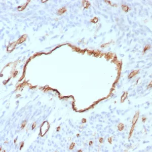 Formalin-fixed, paraffin-embedded human uterus stained with CD31 Rabbit Recombinant Monoclonal Antibody (C31/8593R). HIER: Tris/EDTA, pH9.0, 45min. 2°C: HRP-polymer, 30min. DAB, 5min.