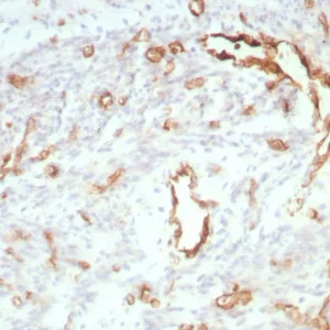 Formalin-fixed, paraffin-embedded human uterus stained with CD31 Rabbit Recombinant Monoclonal Antibody (C31/8828R). HIER: Tris/EDTA, pH9.0, 45min. 2°C: HRP-polymer, 30min. DAB, 5min.