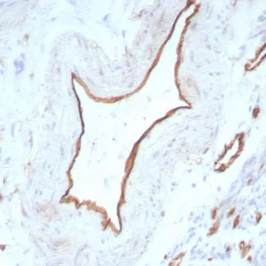 Formalin-fixed, paraffin-embedded human uterus stained with CD31 Rabbit Recombinant Monoclonal Antibody (C31/8831R). HIER: Tris/EDTA, pH9.0, 45min. 2°C: HRP-polymer, 30min. DAB, 5min.