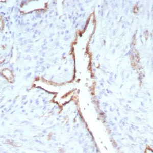 Formalin-fixed, paraffin-embedded human uterus stained with CD31 Rabbit Recombinant Monoclonal Antibody (C31/9224R). HIER: Tris/EDTA, pH9.0, 45min. 2°C: HRP-polymer, 30min. DAB, 5min.