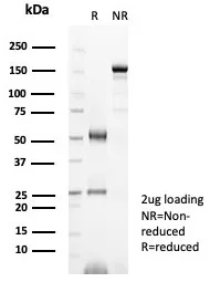 SDS-PAGE Analysis  Purified PR Recombinant Rabbit Monoclonal (PGR/8099R).  Confirmation of Integrity and Purity of Antibody.