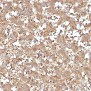 Formalin-fixed, paraffin-embedded human liver stained with Alpha-1-Antitrypsin Mouse Monoclonal Antibody (AAT/4615). HIER: Tris/EDTA, pH9.0, 45min. 2°C: HRP-polymer, 30min. DAB, 5min.