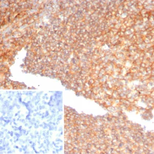 Formalin-fixed, paraffin-embedded human tonsil stained with Alpha-1-Antitrypsin Mouse Monoclonal Antibody (AAT/4486). HIER: Tris/EDTA, pH9.0, 45min. 2°C: HRP-polymer, 30min. DAB, 5min.