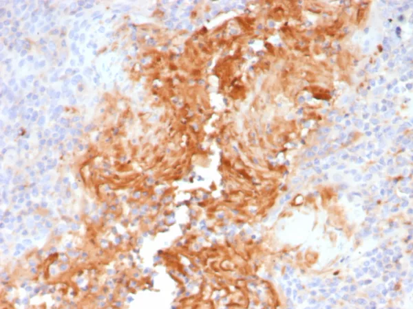 Formalin-fixed, paraffin-embedded human tonsil stained with Alpha-1-Antitrypsin Mouse Monoclonal Antibody (AAT/4490). HIER: Tris/EDTA, pH9.0, 45min. 2°C: HRP-polymer, 30min. DAB, 5min.