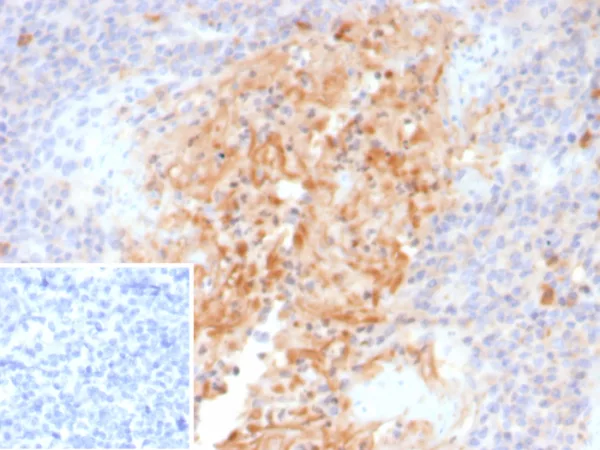 Formalin-fixed, paraffin-embedded human tonsil stained with Alpha-1-Antitrypsin Mouse Monoclonal Antibody (AAT/4571). HIER: Tris/EDTA, pH9.0, 45min. 2°C: HRP-polymer, 30min. DAB, 5min.
