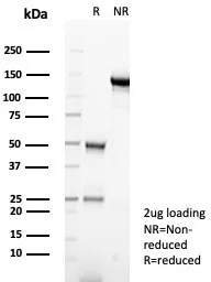 SDS-PAGE Analysis of Purified Alpha-1-Antitrypsin Mouse Monoclonal (AAT/6323). Confirmation of Purity and Integrity of Antibody.