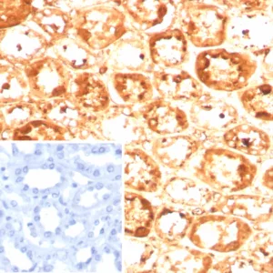 Formalin-fixed, paraffin-embedded human kidney stained with Alpha-1-Antitrypsin Mouse Monoclonal (AAT/8909). Inset: PBS instead of primary antibody; secondary only negative control.