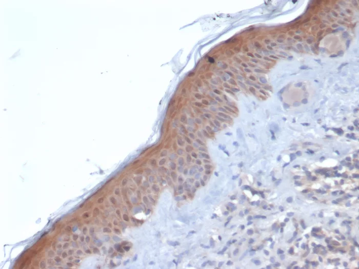 Formalin-fixed, paraffin-embedded human skin stained with Maspin Mouse Monoclonal Antibody (SERPINB5/4971). HIER: Tris/EDTA, pH9.0, 45min. 2°C: HRP-polymer, 30min. DAB, 5min. SERPINB5 / Maspin (Tumor Suppressor & Epithelial Biomarker) Antibody - Image 2