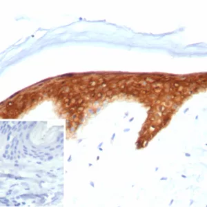 Formalin-fixed, paraffin-embedded human skin stained with Maspin Mouse Monoclonal Antibody (SERPINB5/4974). Inset: PBS instead of primary antibody; secondary only negative control.