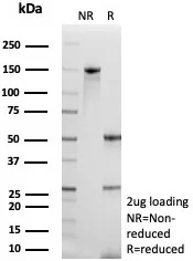 SDS-PAGE Analysis of Purified Maspin Mouse Monoclonal Antibody (SERPINB5/4974). Confirmation of Purity and Integrity of Antibody. SERPINB5 / Maspin (Tumor Suppressor & Epithelial Biomarker) Antibody - Image 2