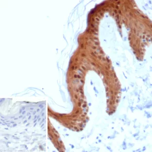 Formalin-fixed, paraffin-embedded human skin stained with SERPINB5 / Maspin Mouse Monoclonal Antibody (SERPINB5/4978). 	Inset: PBS instead of primary antibody; secondary only negative control.