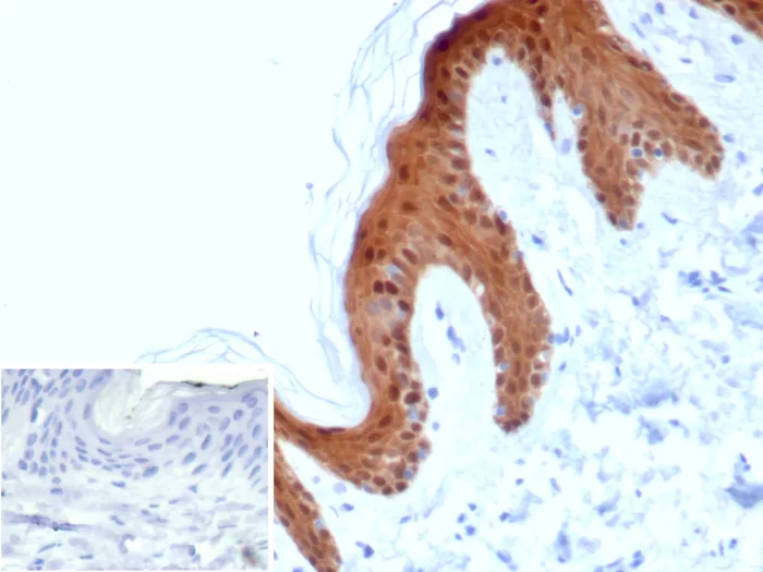 Formalin-fixed, paraffin-embedded human skin stained with SERPINB5 / Maspin Mouse Monoclonal Antibody (SERPINB5/4978). Inset: PBS instead of primary antibody; secondary only negative control. SERPINB5 / Maspin (Tumor Suppressor & Epithelial Biomarker) Antibody