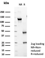 SDS-PAGE Analysis of Purified PTEN Mouse Monoclonal Antibody (PTEN/7344). Confirmation of Purity and Integrity of Antibody.