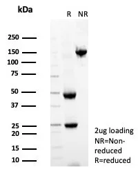 SDS-PAGE Analysis of Purified PTEN Mouse Monoclonal Antibody (PTEN/7345). Confirmation of Purity and Integrity of Antibody.