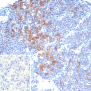 Formalin-fixed, paraffin-embedded human lymph node stained with PIK3CD Mouse Monoclonal Antibody (PIK3CD/4639). Inset: PBS instead of primary antibody; secondary only negative control.
