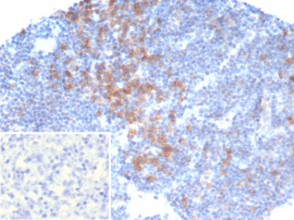 Formalin-fixed, paraffin-embedded human lymph node stained with PIK3CD Mouse Monoclonal Antibody (PIK3CD/4639). Inset: PBS instead of primary antibody; secondary only negative control.