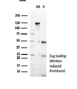 SDS-PAGE Analysis  Purified GCDFP-15 Mouse Monoclonal Antibody (PIP/7477). Confirmation of Integrity and Purity of Antibody.