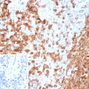 Formalin-fixed, paraffin-embedded human spleen stained with PLK1 Mouse Monoclonal Antibody (PLK1/7122). Inset: PBS instead of primary antibody; secondary only negative control.