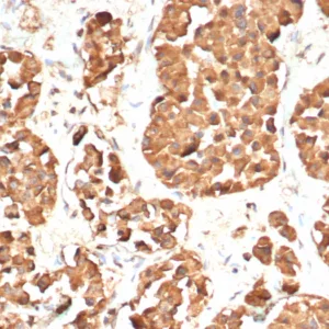 Formalin-fixed, paraffin-embedded human pituitary gland stained with ACTH Recombinant Rabbit Monoclonal Antibody (CLIP/7197R). HIER: Tris/EDTA, pH9.0, 45min. 2°C: HRP-polymer, 30min. DAB, 5min.
