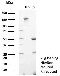 SDS-PAGE Analysis of Purified PON1 Mouse Monoclonal Antibody (PON1/1351). Confirmation of Purity and Integrity of Antibody.