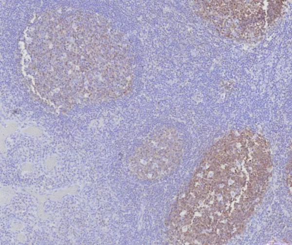 Formalin-fixed, paraffin-embedded human tonsil stained with  BOB1 Mouse Monoclonal Antibody (BOB1/7469). HIER: Tris/EDTA, pH9.0, 45min. 2°C: HRP-polymer, 30min. DAB, 5min.