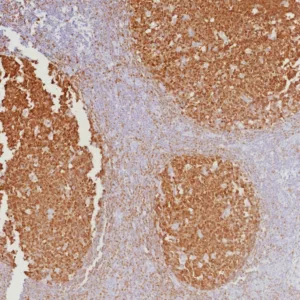 Formalin-fixed, paraffin-embedded human tonsil stained with BOB1 Mouse Monoclonal Antibody (BOB1/7467). HIER: Tris/EDTA, pH9.0, 45min. 2°C: HRP-polymer, 30min. DAB, 5min.