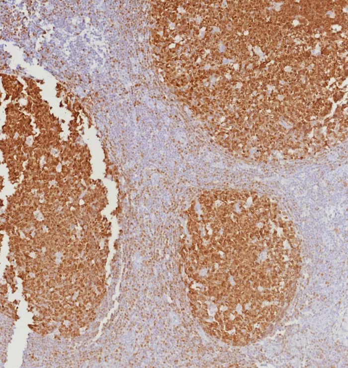 Formalin-fixed, paraffin-embedded human tonsil stained with BOB1 Mouse Monoclonal Antibody (BOB1/7467). HIER: Tris/EDTA, pH9.0, 45min. 2°C: HRP-polymer, 30min. DAB, 5min. BOB.1 (B-Cell Marker) Antibody