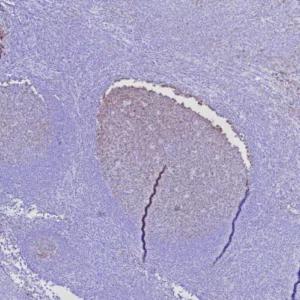 Formalin-fixed, paraffin-embedded human tonsil stained with BOB1 Mouse Monoclonal Antibody (BOB1/7468). HIER: Tris/EDTA, pH9.0, 45min. 2°C: HRP-polymer, 30min. DAB, 5min.