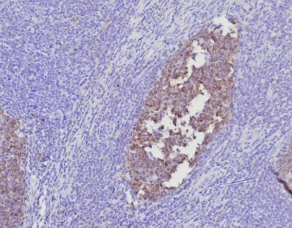 Formalin-fixed, paraffin-embedded human tonsil stained with  BOB1 Mouse Monoclonal Antibody (BOB1/7468). HIER: Tris/EDTA, pH9.0, 45min. 2°C: HRP-polymer, 30min. DAB, 5min.