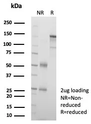 SDS-PAGE Analysis of Purified L1TD1 Mouse Monoclonal Antibody (L1TD1/7941). Confirmation of Purity and Integrity of Antibody.