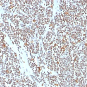 Formalin-fixed, paraffin-embedded human colon stained with ATRX Mouse Monoclonal Antibody (ATRX/7940). HIER: Tris/EDTA, pH9.0, 45min. 2°C: HRP-polymer, 30min. DAB, 5min.