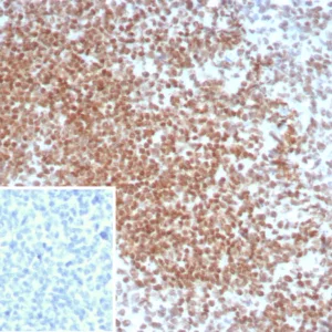 Formalin-fixed, paraffin-embedded human seminoma stained with OCT4 Recombinant Rabbit Monoclonal Antibody (OCT4/8098R). Inset: PBS instead of primary antibody; secondary only negative control.