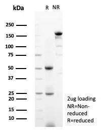 SDS-PAGE Analysis of Purified FEV Mouse Monoclonal Antibody (FEV/7311). Confirmation of Purity and Integrity of Antibody.