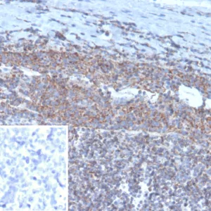 Formalin-fixed, paraffin-embedded human tonsil stained with  BCOR Mouse Monoclonal Antibody (BCOR/1311). Inset: PBS instead of primary antibody; secondary only negative control.