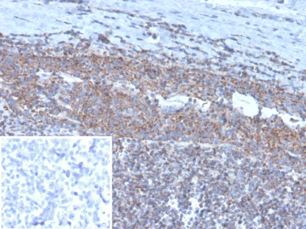 Formalin-fixed, paraffin-embedded human tonsil stained with  BCOR Mouse Monoclonal Antibody (BCOR/1311). Inset: PBS instead of primary antibody; secondary only negative control.