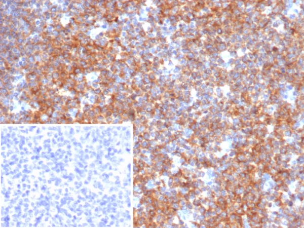 Formalin-fixed, paraffin-embedded human tonsil stained with  BCOR Mouse Monoclonal Antibody (BCOR/2372). Inset: PBS instead of primary antibody; secondary only negative control.