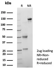 SDS-PAGE Analysis of Purified PSAP Recombinant Rabbit Monoclonal Antibody (ACPP/8409R). Confirmation of Purity and Integrity of Antibody.