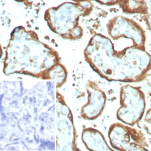 Formalin-fixed, paraffin-embedded human placenta stained with IMP-3 Recombinant Rabbit Monoclonal Antibody (IMP3/8934R) Inset: PBS instead of primary antibody; secondary only negative control.