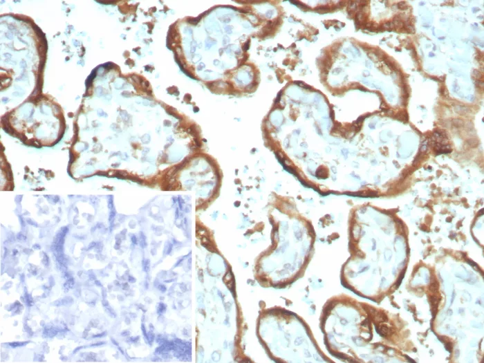 Formalin-fixed, paraffin-embedded human placenta stained with IMP-3 Recombinant Rabbit Monoclonal Antibody (IMP3/8934R) Inset: PBS instead of primary antibody; secondary only negative control. Recombinant IMP-3 Antibody