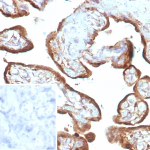 Formalin-fixed, paraffin-embedded human placenta stained with IMP-3 Recombinant Rabbit Monoclonal Antibody (IMP3/8985R) Inset: PBS instead of primary antibody; secondary only negative control.