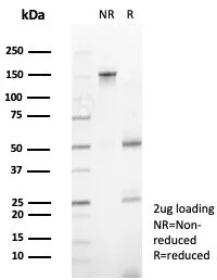 SDS-PAGE Analysis of Purified ZNF444 Mouse Monoclonal Antibody (PCRP-ZNF444-1E11). Confirmation of Purity and Integrity of Antibody.