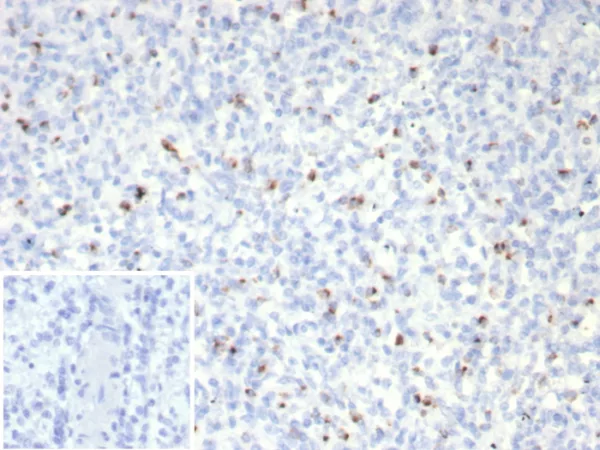 Formalin-fixed, paraffin-embedded human spleen stained with Perforin-1 Recombinant Mouse Monoclonal Antibody (rPRF1/8058). Inset: PBS instead of primary antibody; secondary only negative control.