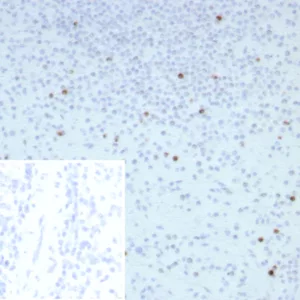 Formalin-fixed, paraffin-embedded human spleen stained with Perforin-1 Recombinant Rabbit Monoclonal Antibody (PRF1/8662R). Inset: PBS instead of primary antibody; secondary only negative control.
