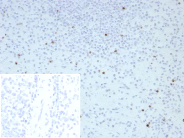 Formalin-fixed, paraffin-embedded human spleen stained with Perforin-1 Recombinant Rabbit Monoclonal Antibody (PRF1/8662R). Inset: PBS instead of primary antibody; secondary only negative control.