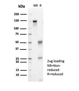 SDS-PAGE Analysis of Purified Kallikrein 7 Mouse Monoclonal Antibody (KLK7/4692). Confirmation of Purity and Integrity of Antibody.