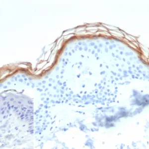 Formalin-fixed, paraffin-embedded human skin stained with Kallikrein 7 Mouse Monoclonal Antibody (KLK7/4693). Inset: PBS instead of primary antibody; secondary only negative control.