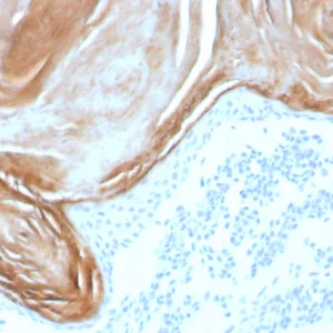 Formalin-fixed, paraffin-embedded human skin stained with Kallikrein 7 Recombinant Rabbit Monoclonal Antibody (KLK7/8971R). HIER: Tris/EDTA, pH9.0, 45min. 2°C: HRP-polymer, 30min. DAB, 5min.